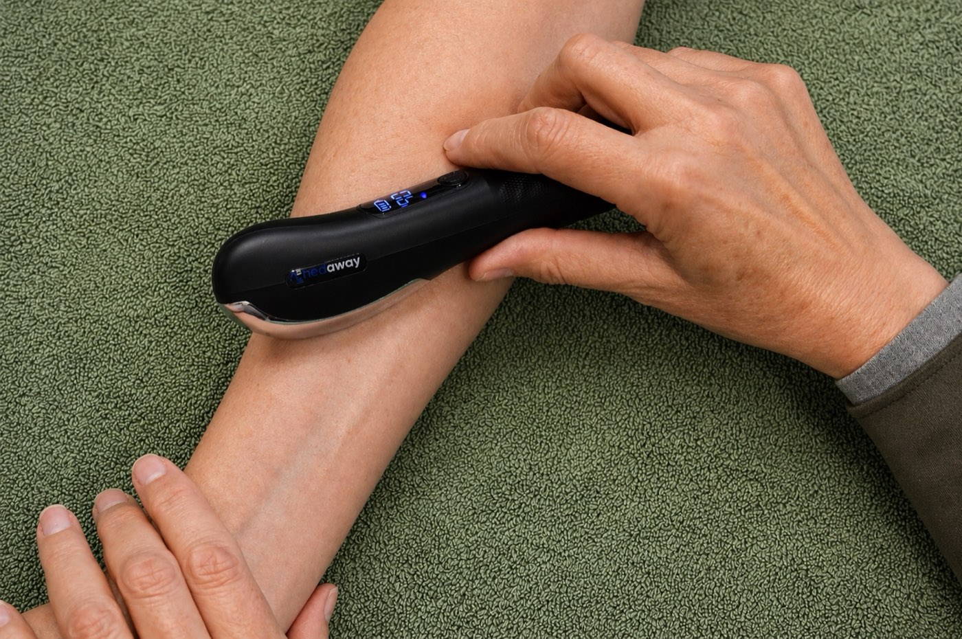 A therapist using a handheld device for scar management treatment on a client's forearm